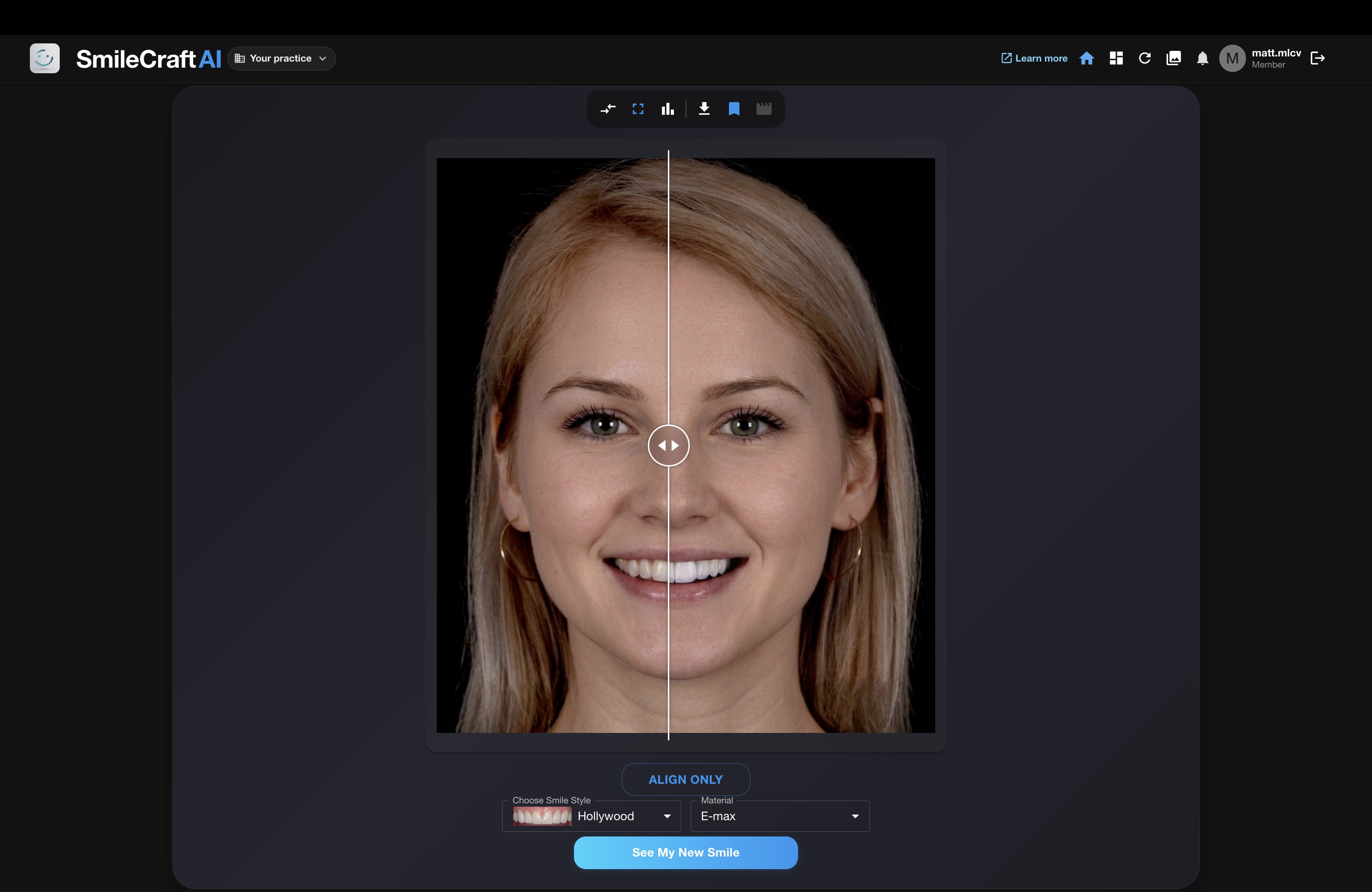 Smile Makeover Showcase